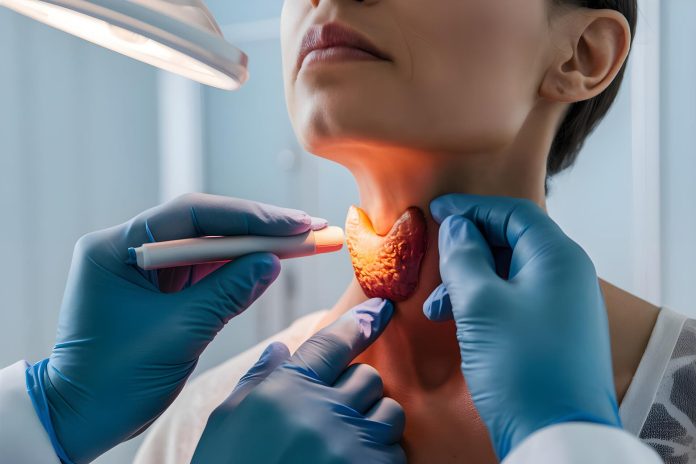 Nódulo na tireoide: técnica sem cortes pode evitar cirurgia em casos selecionados