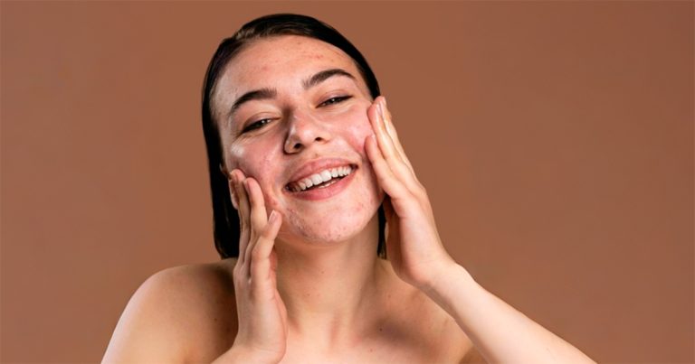 USP procura por voluntárias para estudo clínico sobre formulação cosmética