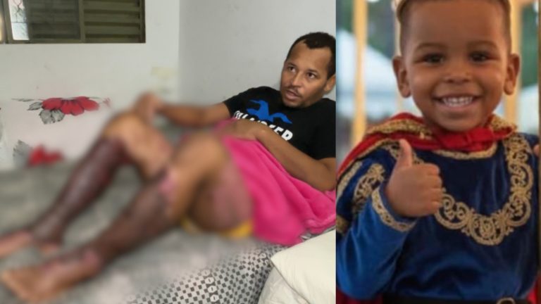 Explosão que queimou gravemente pai e filho em Valinhos completa um mês; amigos organizam bazar para ajudar a família