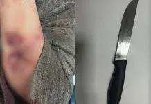 Mulher é atacada por ex-companheiro de madrugada enquanto dormia em casa