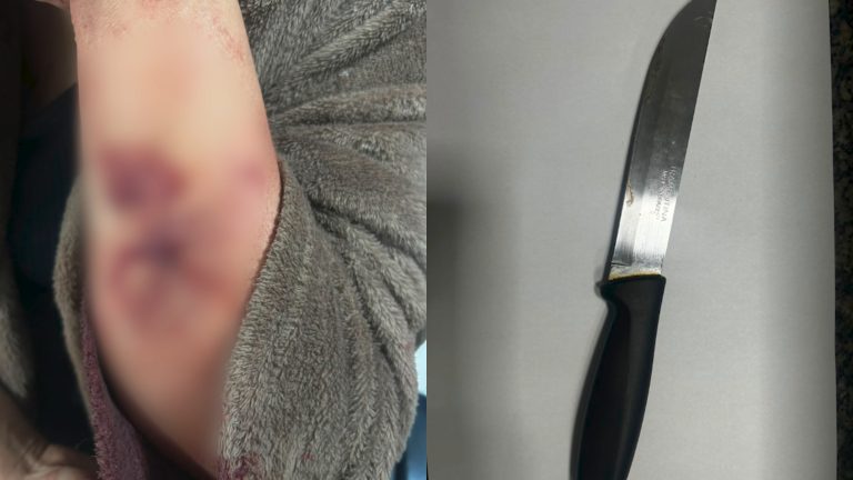 Mulher é atacada por ex-companheiro de madrugada enquanto dormia em casa