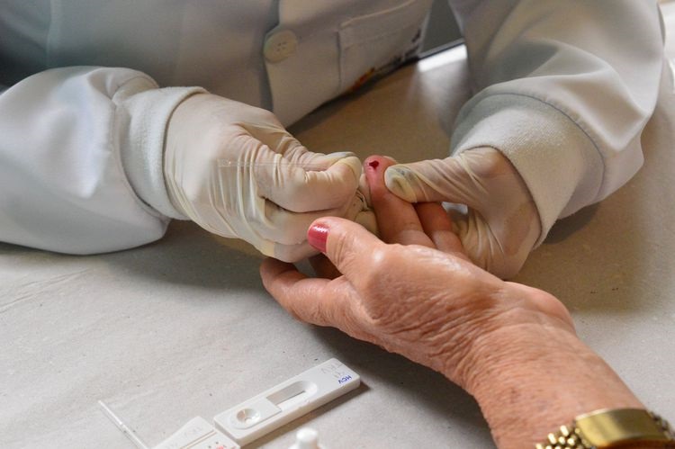A partir de segunda (20): Prefeitura anuncia testagem de hepatites B e C e inclui manicures entre público-alvo
