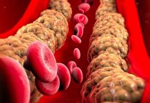 Colesterol alto: FDA aprova primeiro inibidor oral da PCSK9