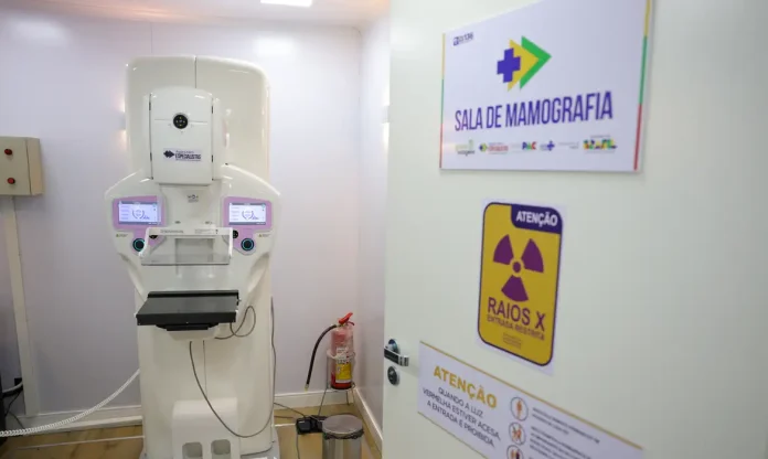 Cirurgias de mama no SUS cresceram 54,3% em dez anos. São Paulo lidera os procedimentos, com mais de 30 mil operações entre 2016 e 2025