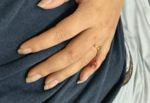 Homem é preso pela GCM após agredir esposa com socos e golpes de faca
