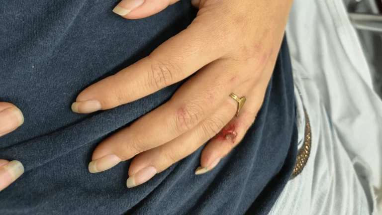 Homem é preso pela GCM após agredir esposa com socos e golpes de faca
