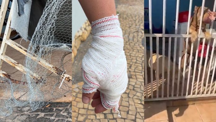 Pitbulls escapam de casa e atacam três pessoas em avenida de Americana Pitbulls escapam de casa e atacam três pessoas em avenida de Americana