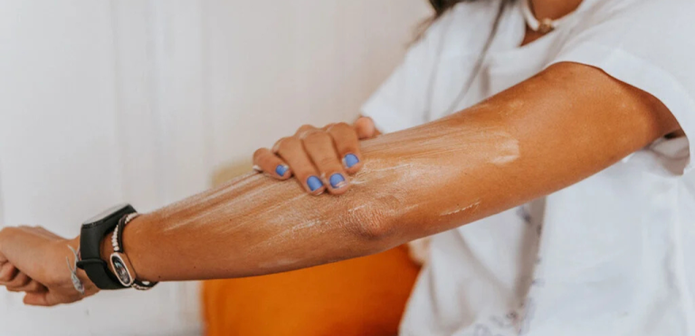 Cuidados com a pele no inverno: veja como evitar o ressecamento