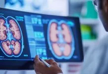 Doença renal crônica pode elevar risco de infarto e AVC e exige cuidado integrado
