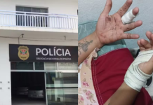 Homem descumpre medida protetiva, esfaqueia e tenta estrangular a ex-companheira em Registro