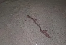 Jovem sobrevive a tiros na cabeça e ajuda polícia a prender suspeitos
