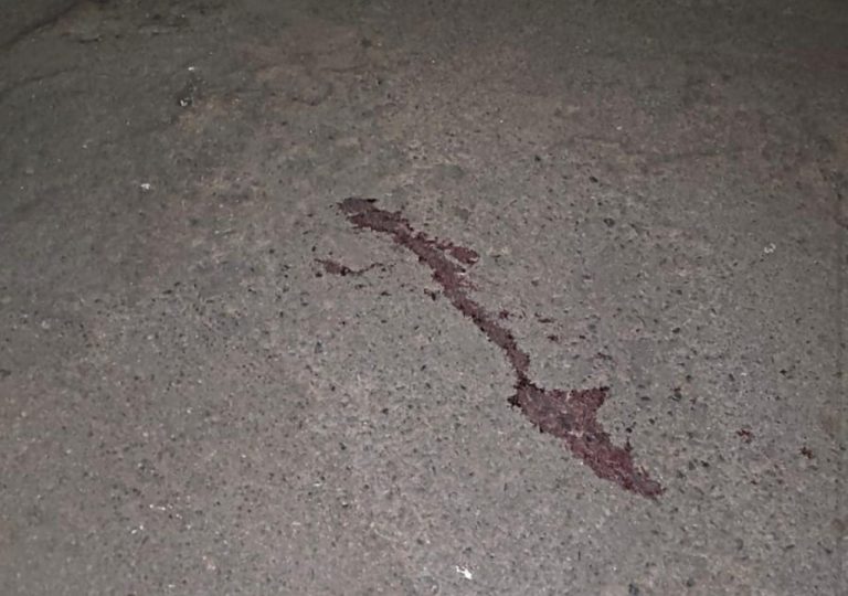 Jovem sobrevive a tiros na cabeça e ajuda polícia a prender suspeitos