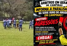 Árbitro agredido durante jogo amador em Campinas vai precisar passar por cirurgia