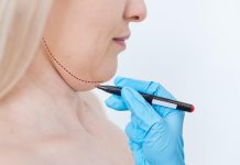 Cirurgia de pescoço ganha espaço quando flacidez e papada vão além da pele