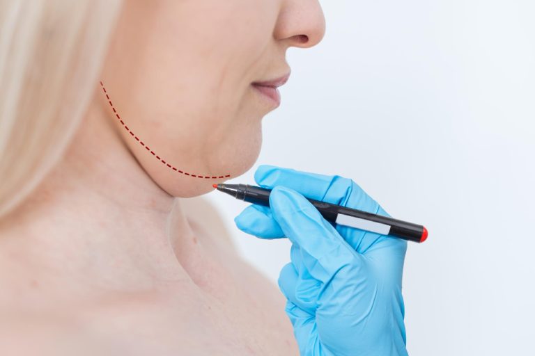 Cirurgia de pescoço ganha espaço quando flacidez e papada vão além da pele
