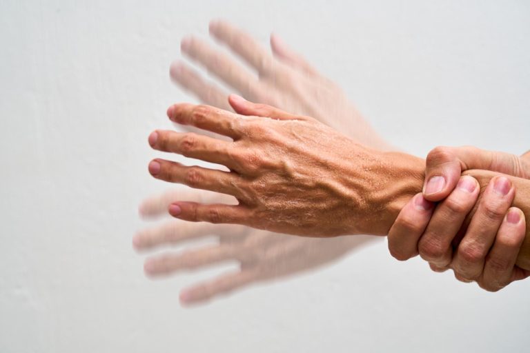 Parkinson avançado: por que o remédio parece falhar e quais são as opções atuais